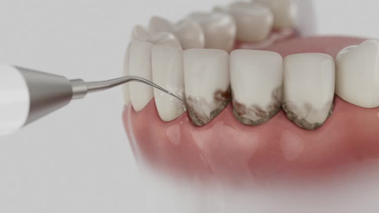 Reliable Dental Implants contractor in Lewis County County, WV by Dentist Open Now